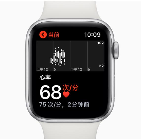 苹果新一代Apple Watch 6亮点曝光，内置血氧感测功能
